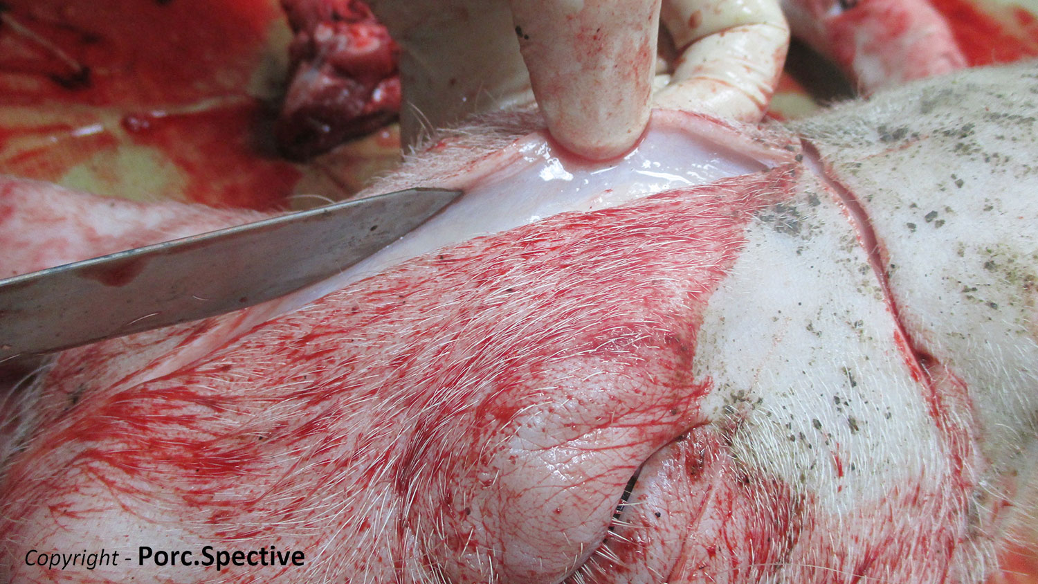 Foto 1: &Ouml;dem der Subkutis am Vorderkopf
