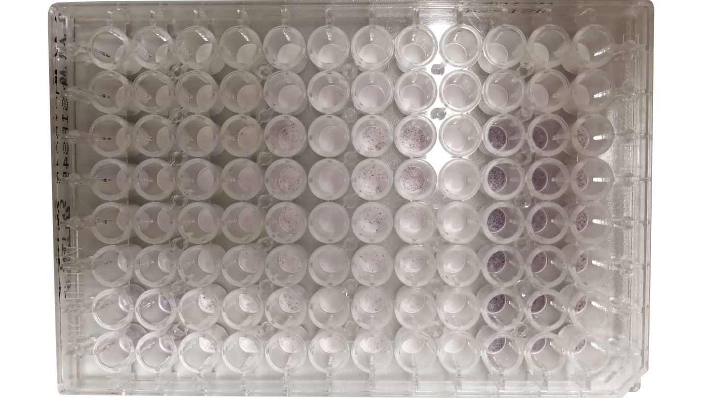 Beispiel f&uuml;r die Messung von PRRSV-spezifischen, Interferon-gamma (IFN-&gamma;) sezernierenden Zellen durch einen ELISPOT-Assay (Enzyme Linked Immuno Spot Assay) mit Hilfe einer 96er-Mikrotiterplatte.
