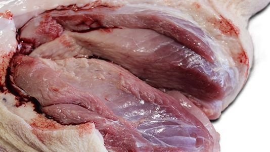 Deutliche Aufhellung des M. semimembranosus