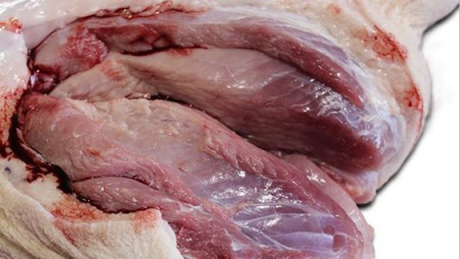 Deutliche Aufhellung des M. semimembranosus