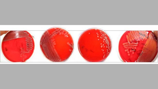 Verschiedene Koloniemorphologien auf Blutagar