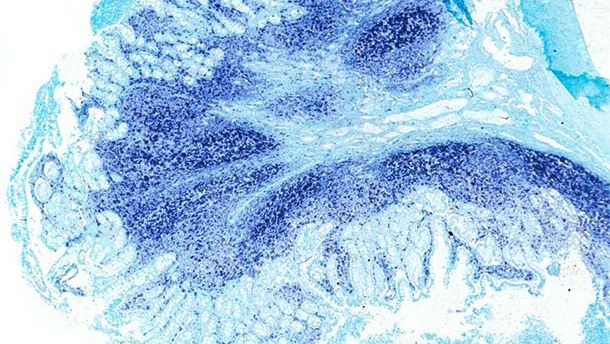 Ileum: Dasselbe Ileum des von der PCV2-bedingten systemischen Erkrankung betroffenen Schweins zeigt gro&szlig;e Mengen des PCV2-Genoms in den Peyer-Plaques und in der Darmschleimhaut. In-situ-Hybridisierung zum Nachweis von PCV2: schnelle gr&uuml;ne Gegenf&auml;rbung.