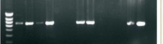 PCR para la detecci&oacute;n de DNA de PCV2