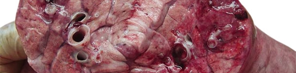 Corte de un pulm&oacute;n