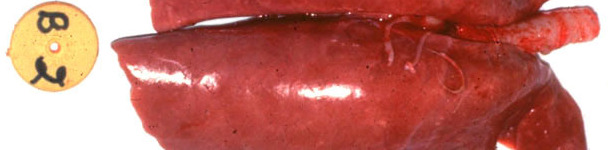 Lesi&oacute;n macrosc&oacute;pica de pulm&oacute;n