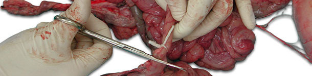 Ligar el tramo del intestino por los extremos antes de cortar.