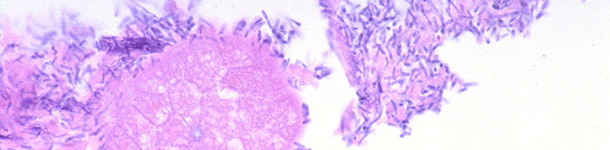 Intestino delgado de un lech&oacute;n con diarrea asociado a infecci&oacute;n por Clostridium perfringens tipo A