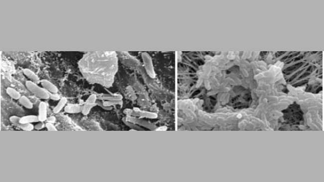 Biofilm