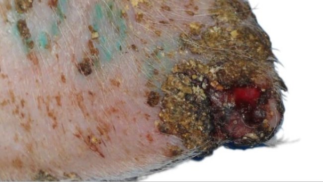 Ulceración, formación de costras y engrosamiento de la epidermis