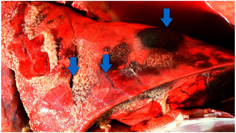 Los tres hallazgos t&iacute;picos de la pleuropneumonia porcina aguda: 1) &aacute;reas consolidadas de color rojo oscuro a negro; 2) edema interlobular y 3) pleuritis fibrinosa. Cortes&iacute;a del Dr Robert Desrosiers
