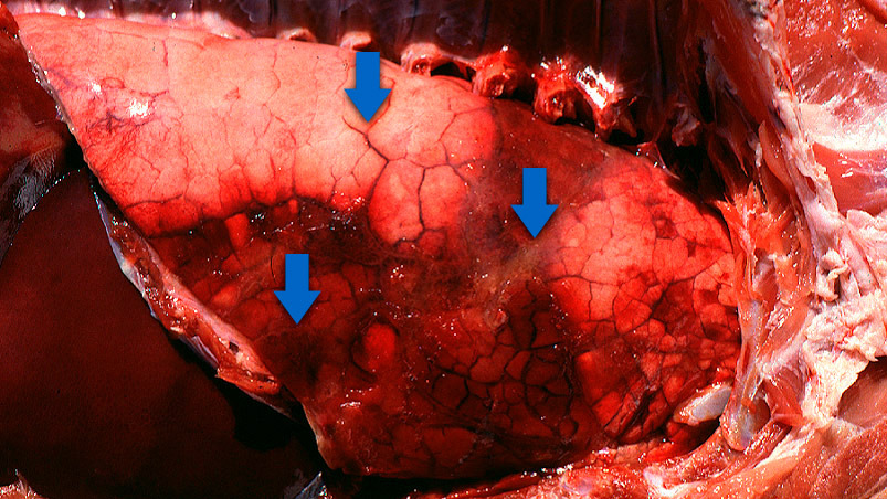 Pleuropneumonia en porcino: &aacute;reas consolidadas, edema interlobular y una sutil pleuritis fibrinosa. Cortes&iacute;a del Dr Robert Desrosiers
