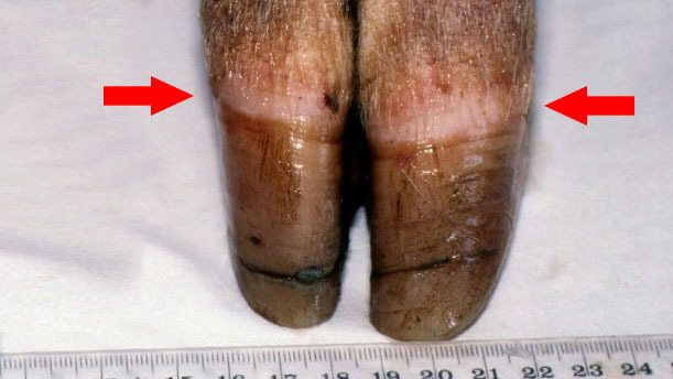 Figura 1. Banda coronaria [flecha]. N&oacute;tese el crecimiento desigual y el agrietamento de la pezu&ntilde;a.
