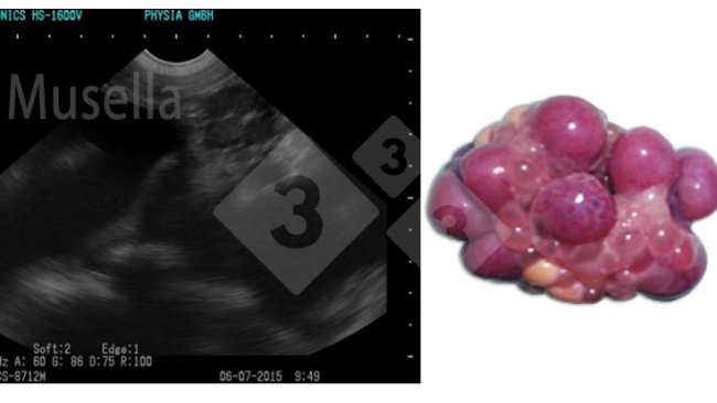 Figura 1. Cuerpo lúteo.