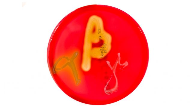 Figura&nbsp;1. Cultivos en placas de Petri en agar sangre que muestran hem&oacute;lisis alfa, beta y gamma. Fuente:&nbsp;Mibilehr https://creativecommons.org/licenses/by-sa/4.0/deed.ene&nbsp;
