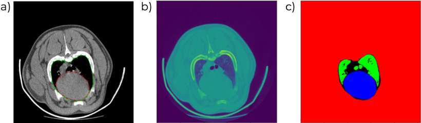 Figura 6. Im&aacute;genes de TC donde se identifican el volumen y perfil card&iacute;aco (a,b) y se diferencian&nbsp;los distintos tipos de tejido de forma autom&aacute;tica (c).
