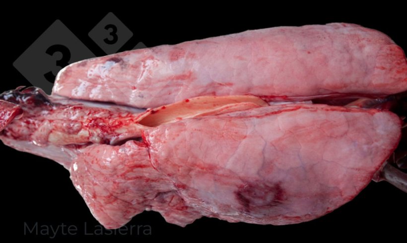 Pleuritis dorsocaudal
