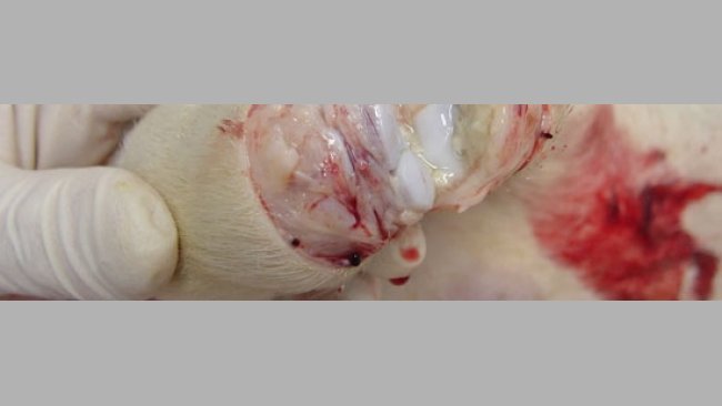 Poliartritis purulenta