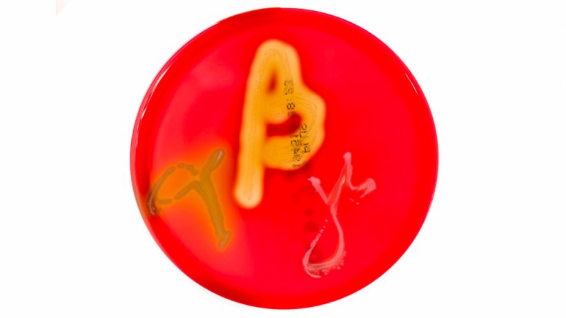 Figura&nbsp;1. Cultivos en placas de Petri en agar sangre que muestran hem&oacute;lisis alfa, beta y gamma. Fuente:&nbsp;Mibilehr https://creativecommons.org/licenses/by-sa/4.0/deed.ene&nbsp;
