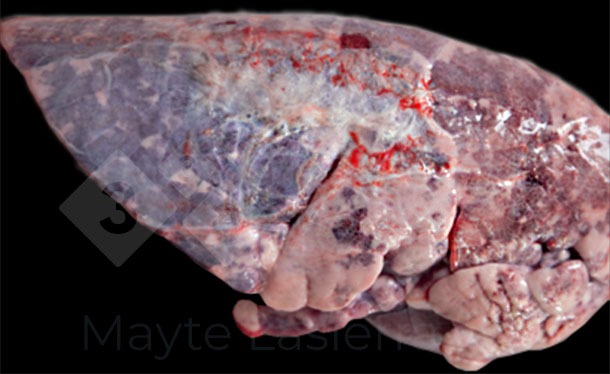 Pleuritis dorsocaudal
