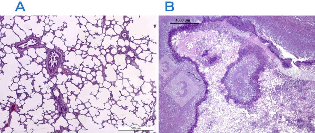 <p>Figura 2. Tinci&oacute;n hematoxilina-eosina&nbsp;en un pulm&oacute;n normal (<strong>A</strong>) y afectado (<strong>B</strong>). El pulm&oacute;n en B est&aacute; afectado por una pleuroneumon&iacute;a fibrino-necrotizante causada por <em>Actinobacillus pleuropneumoniae</em>.</p>
