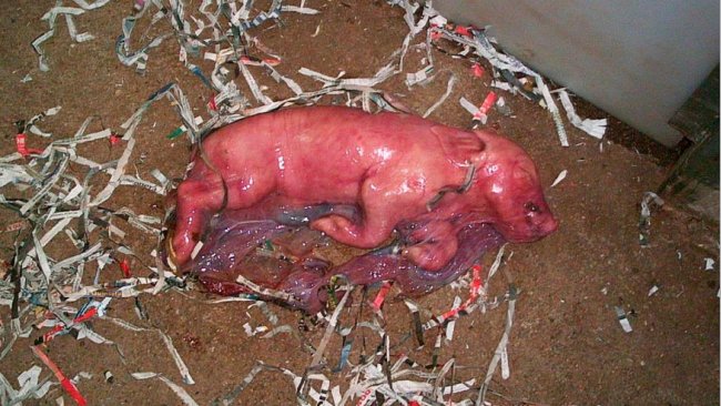 Monitorización de partos: Sistemas de control