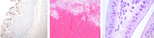 Rotavirus, E.coli y Clostridium perfringens