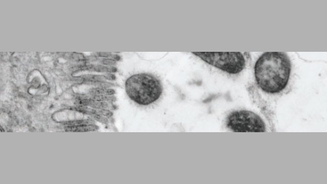 Bacteria ETEC