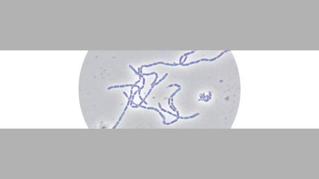 Figura 2. Lactobacillus rhamnosus CTC1679 al microscopio óptico de contraste de fases