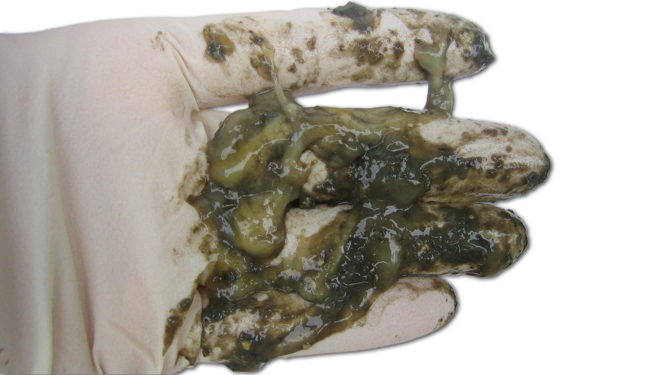 Diarrea catarral
