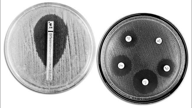 Técnicas clásicas de evaluación de la resistencia a antibióticos. A la izquierda se muestra un E-TEST que permite medir la concentración mínima de antibiótico que impide el crecimiento bacteriano. A la derecha se muestra un antibiograma en el que se observan diferentes halos de inhibición del crecimiento por parte de los antibióticos.