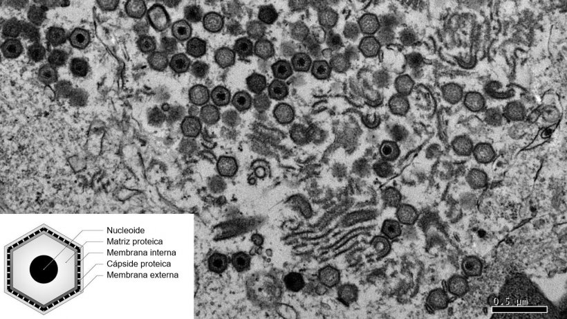 Imagen por microscop&iacute;a electr&oacute;nica de una c&eacute;lula infectada por el virus de la PPA.
