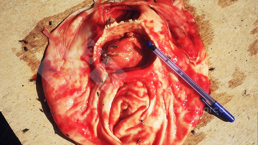 Photo 1. Advanced gastric ulcer.