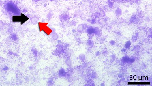 Fecal smear stained with Diff-Quick. Red arrow indicates the central vacuole. Black arrow indicates the nucleus
