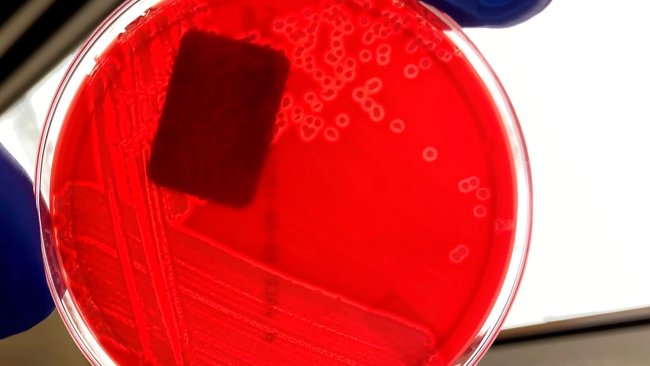 Rycina 1. Czysta hodowla hemolitycznej bakterii E. coli na płytce agarowej z krwią. Zwróć uwagę na czystą strefę wokół każdej kolonii bakteryjnej, wskazującą na hemolizę (rozkład krwi w agarze płytkowym). Zdjęcia: Iowa State University, Weterynaryjne Laboratorium Diagnostyczne, Sekcja Bakteriologii