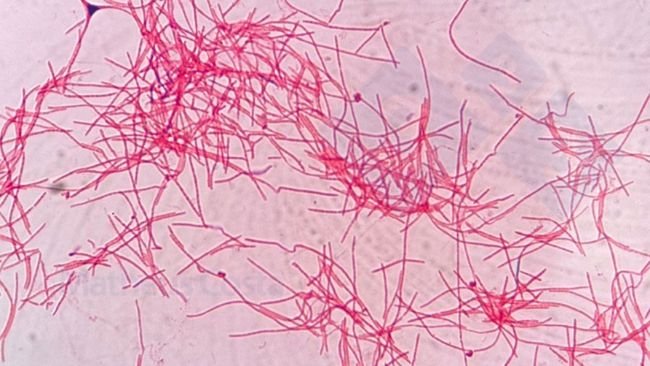 Рисунок 2. Fusobacterium necrophoru под микроскопом.