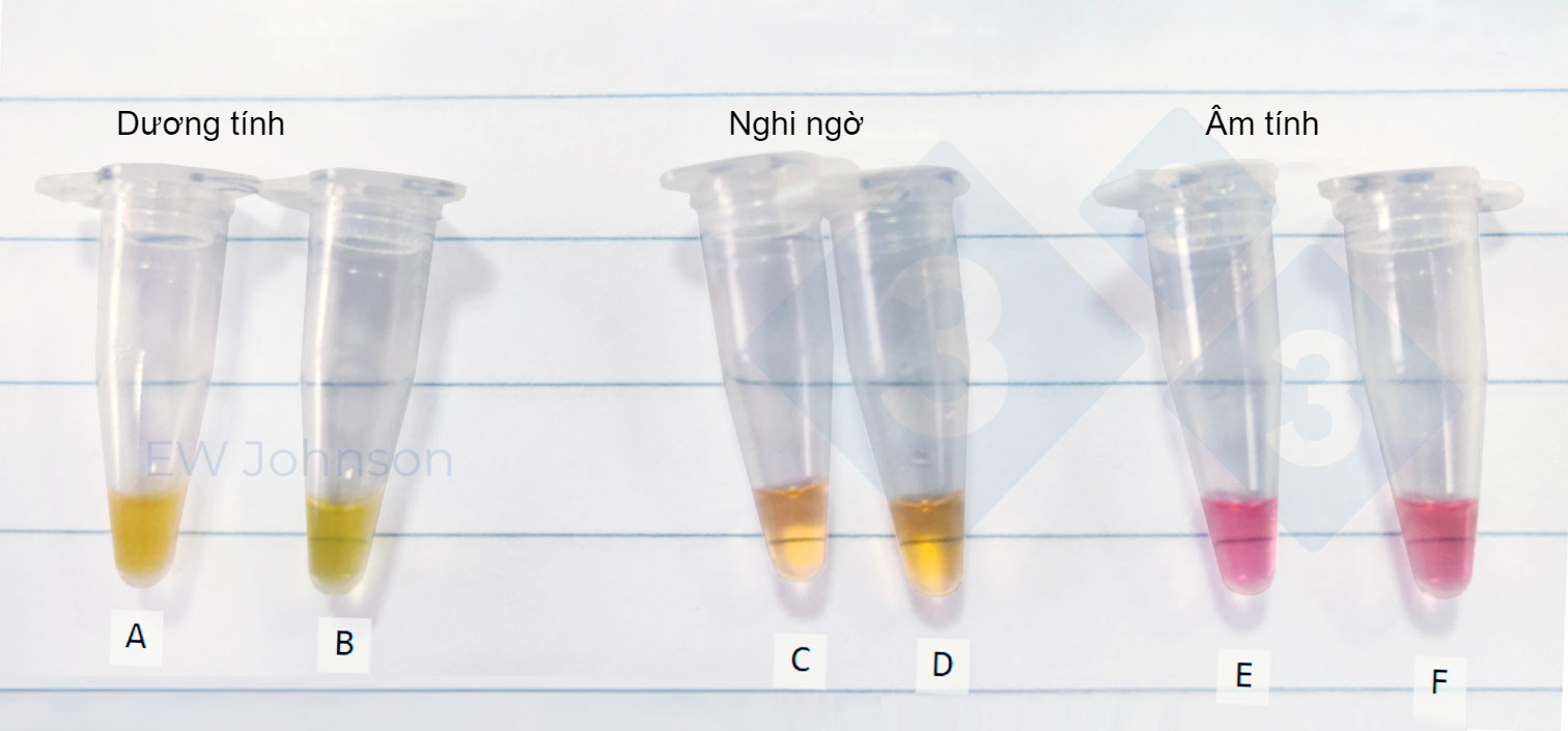 Microcentrifuge tubes from an on-site test of the LAMP method in an ASF case