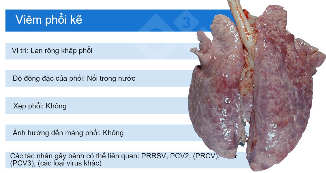 Interstitial pneumonia