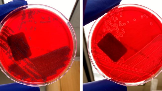 E. coli không tan huyết (trái) và E. coli tan huyết (phải).
