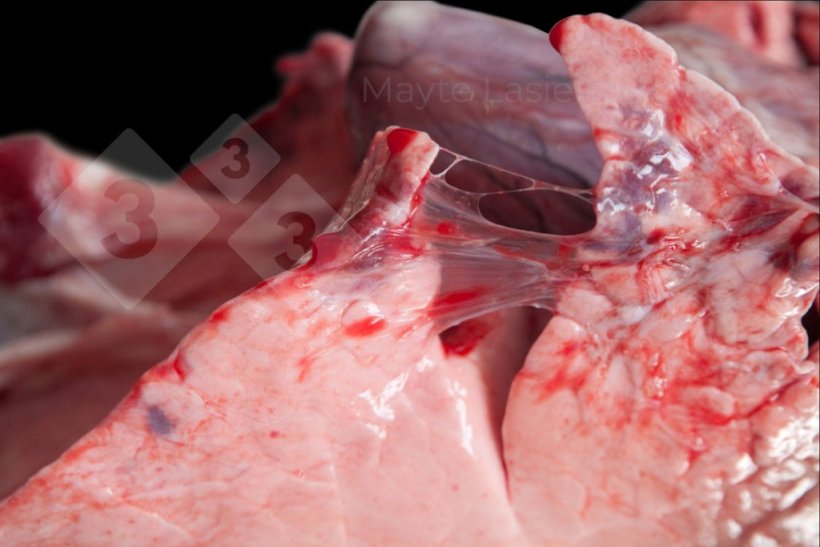 Vi&ecirc;m m&agrave;ng phổi v&ugrave;ng r&igrave;a
